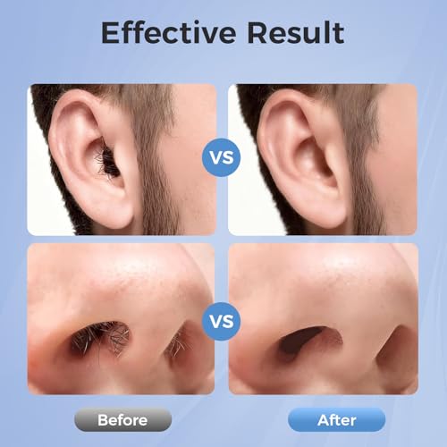 Nose Wax Kit Men: Nose and Ear Hair Removal Kit with Smart Temperature Control & USB C Fast Heating, Nose Hair Wax Kit Includes 100g Hard Wax Beans 20 Sticks & Travel Bag | Lasts up to 7 Weeks 15 Uses