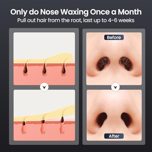 Nose Wax Kit Men, Nose Hair Waxing Kit with 158¡ÆF Smart Temp Control, 40 Sticks, 100g Wax, Painless Nose Hair Removal with USB-C Fast Heating, Upgraded Capacity, Multi-Accessories