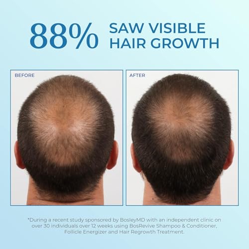 BosleyMD Extra Strength Minoxidil Foam for Hair Regrowth - 2 oz