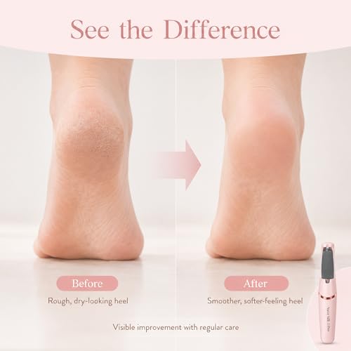 Nuve Silk 3 Pro Electric Callus Remover for Feet