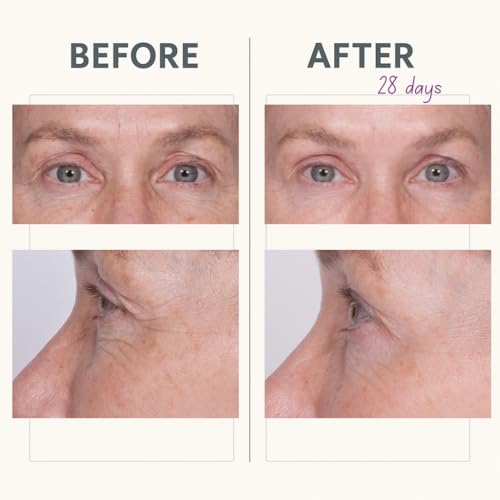 Serious Skincare Reverse Lift Tightening Eye Cream with Peptides, Hydrating Anti-Aging, Temporarily Lift Eyelids, Eyebrow, Under Eye Skin Firming Wrinkle Formula, Women, Men,1 Fl. Oz.