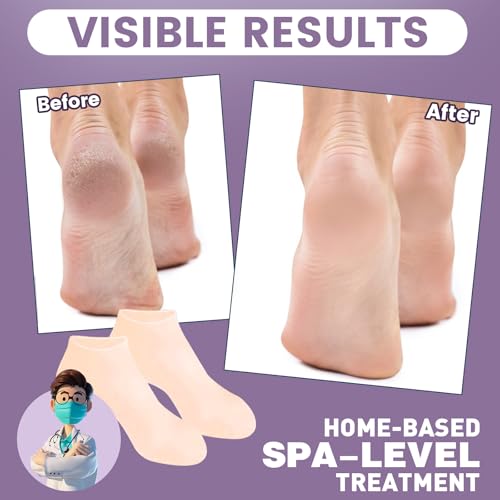 TEAWOO Silicone Moisturizing Socks for Dry Cracked Feet - 5 Pairs Pack