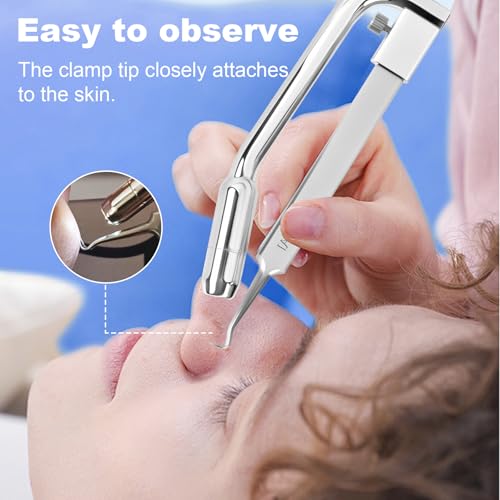 KOSIMAI Silver Blackhead Remover Tool with HD Camera & 30x Magnification