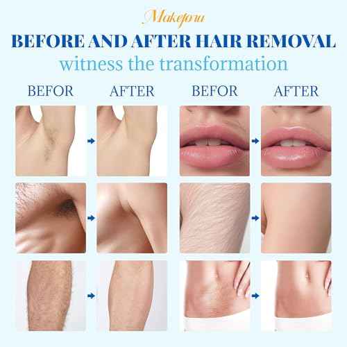 Hair Removal Wax Beads 2.2lb (1000g), Waxing for Whole Body, Painless Hair Removal Waxing for Women and Men, 10 Flavours, Contains 20 Wax Sticks