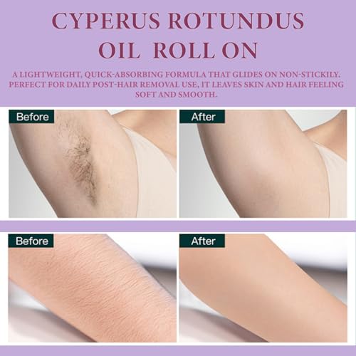 Cyperus Rotundus Serum Roll-On ? Post Hair Removal Soothing Care, Natural Plant-Based Formula for Sensitive Skin, Non-Greasy Daily Skin Comfort (1)