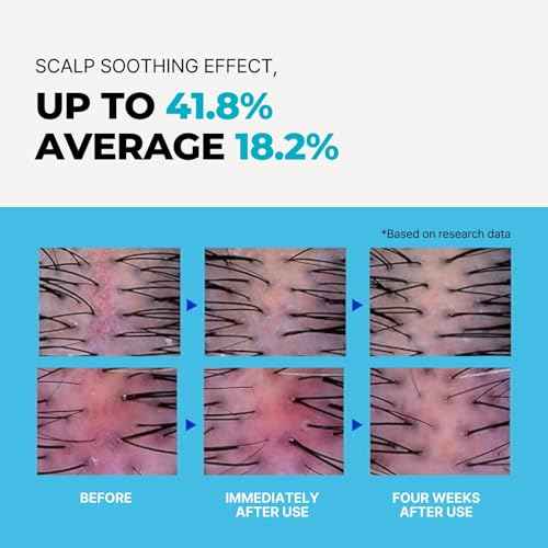 Chlorine Removing Shampoo for Swimmers | Vitamin C | Clarifying & Hydrating | Free of Sulfates, Silicones, Parabens (10.58 oz / 300g, Pack of 2)