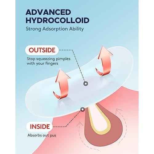 Pimple Patch (360 Counts 4 Sizes), Hydrocolliod Acne Patch for Face, Invisible Zit Patch with Tea Tree Oil & Calendula Oil, Blemish Patch