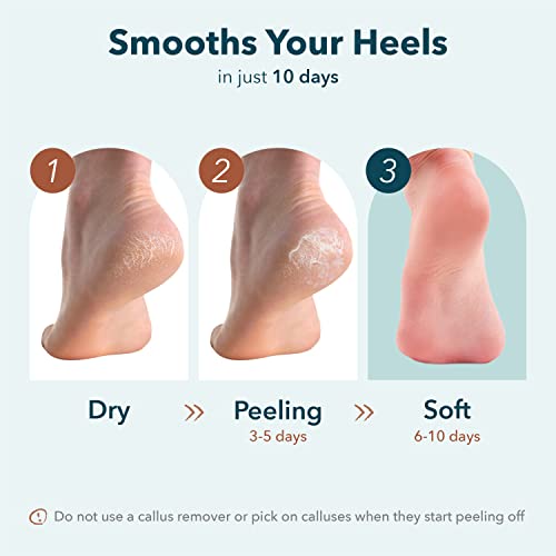 Purederm Exfoliating Foot Peeling Mask for Dry Cracked Heels - 1 Pack