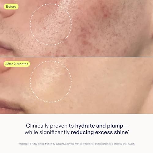 Skinfix Skin Barrier Restoring Gel Cream - 1.7 oz - Non-Greasy Moisturizer for Normal to Combination Skin - Hydrates, Plumps & Smooths - Non-Comedogenic, Fragrance Free, Vegan, Cruelty Free