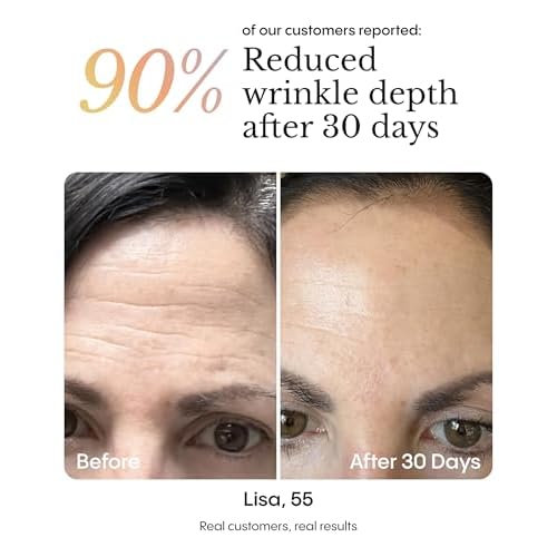 FR¨ªYA Organics | Intensive Wrinkle Night Balm | Arctic Rosehip & Marigold Beeswax Formula | Overnight Skin Renewal for Fine Lines & Wrinkles | Natural Moisturizer | 30ml