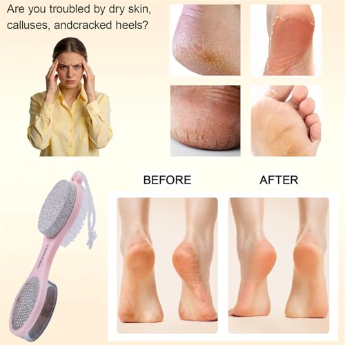 5-in-1 Foot Scrubber Brush & Pumice Stone Callus Remover Pedicure Tool