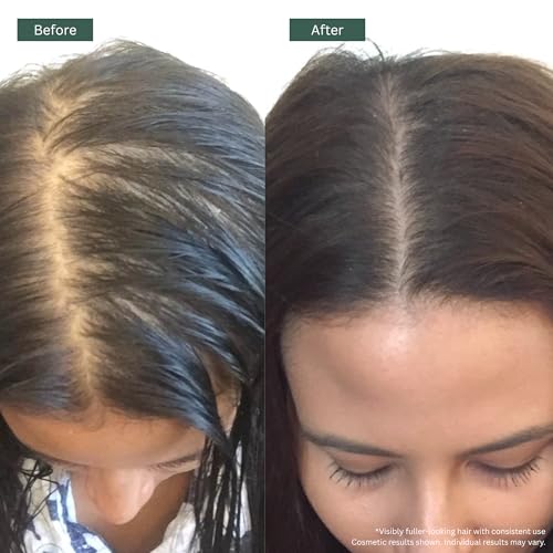 Regrowz Natural Hair Growth Oil - Rosemary, Argan & Jojoba, 3 Pack