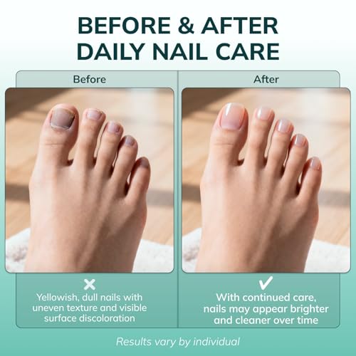Swissklip KlearNail Roll-On Toenail Stick for Discolored & Brittle Nails