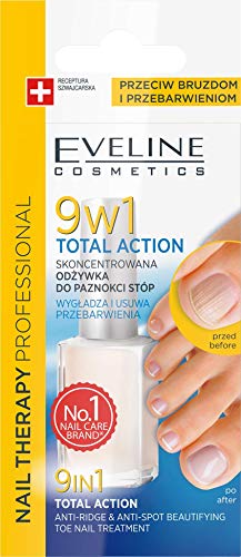 Eveline 9-in-1 Total Action Anti-Ridge Nail Treatment Conditioner