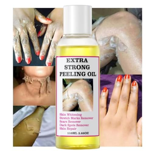 Extra Strong Peeling Oil, Yellow Peeling Oil for Dark Skin, Exfoliating Peeling Solution for Body, Hand, Feet and Face All Skin Type