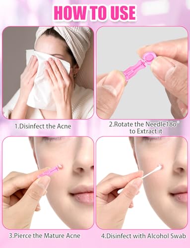 Disposable Facial Extraction Lancets - Pink 50Pcs for Acne Blackhead Removal