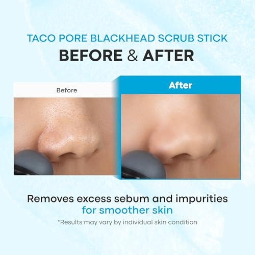 TONYMOLY Tako Pore Clay Scrub Stick - Blackhead Remover