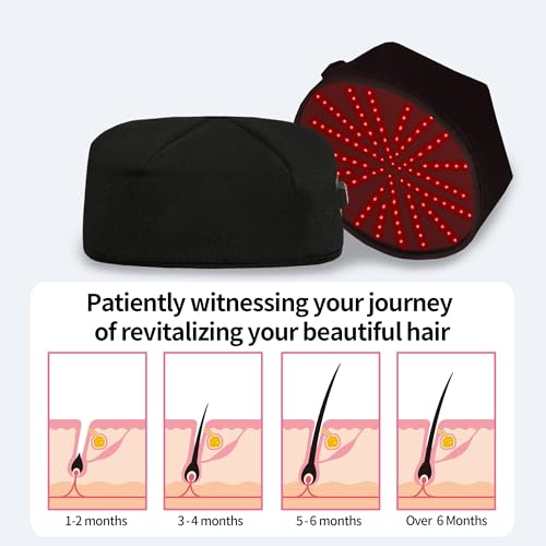 Cordless Red Light Therapy Hair Growth Cap with 5000mAh Battery