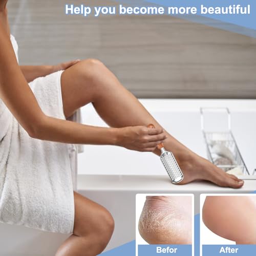 Pedicure Foot File Callus Remover T1 Foot Scrubber for Cracked Heels - Untrytb