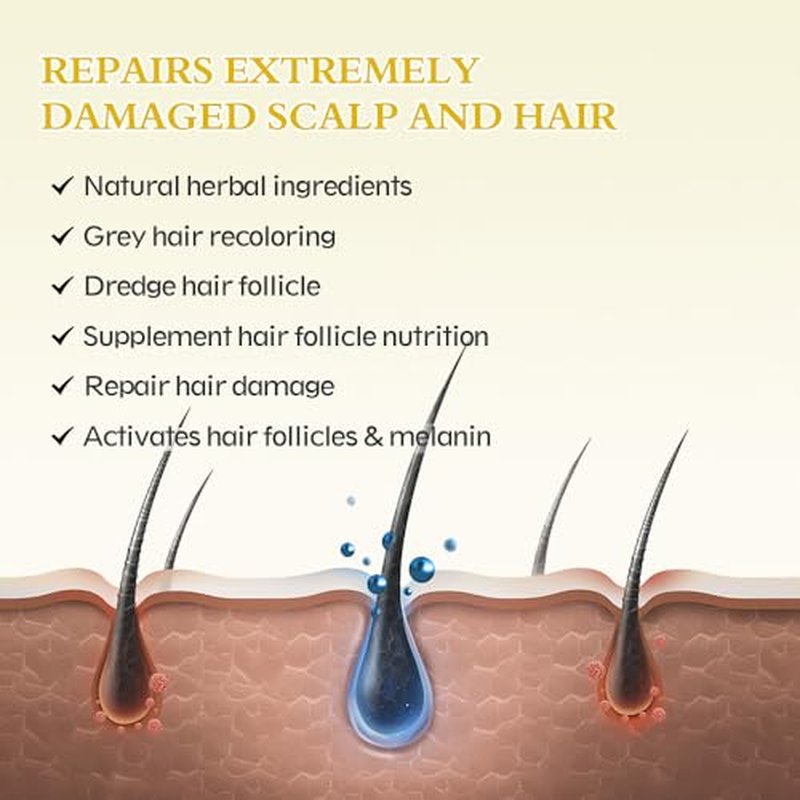5% Minoxidil Hair Growth Serum - 2-Pack for Men & Women