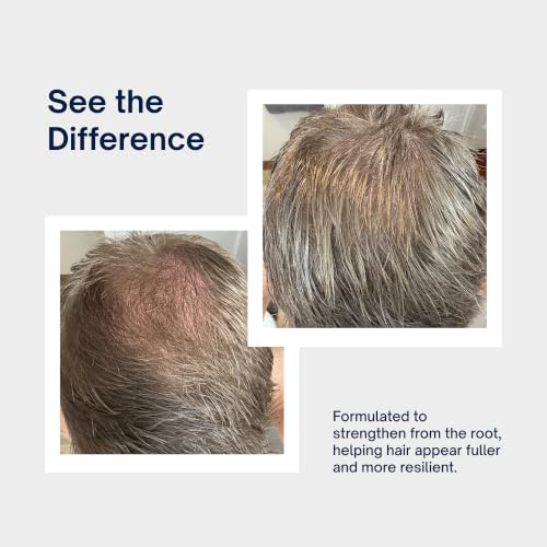 INTELLIGENT Volumizing Shampoo for Thinning Hair 10 fl oz – Scalp Care & Strengthening