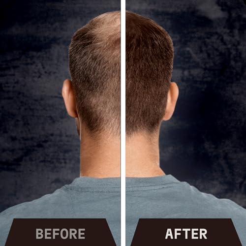 Striking Viking Hair Fibers Dark Brown 28g - Hair Thickening Powder