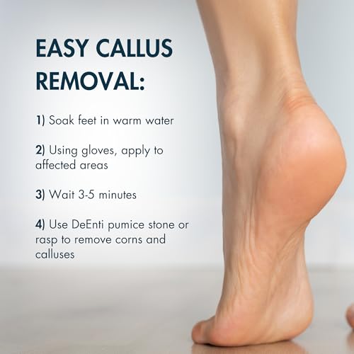 Mint Callus Remover Kit with Pumice Stones & Gloves for Smooth Feet