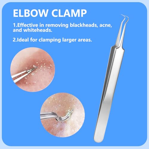 5PCS Blackhead Remover Kit Stainless Steel Comedone Extractors for Acne