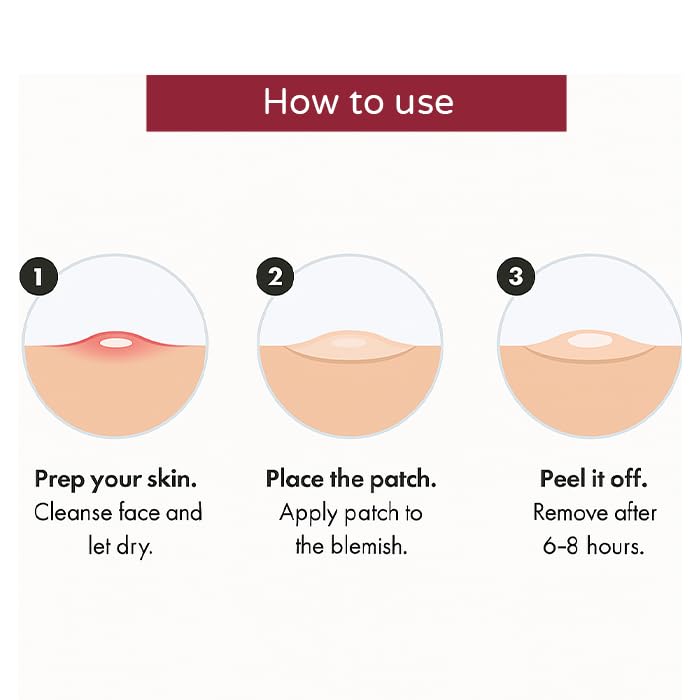 Muvex Acne Patches - Hydrocolloid Pimple Treatment, 72 Count