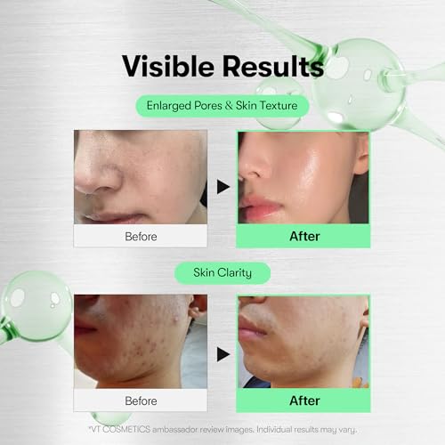 VT COSMETICS CICA Reedle Shot 300 + PDRN Capsule Cream 100 Bundle | Microneedling Serum & Hydrating PDRN