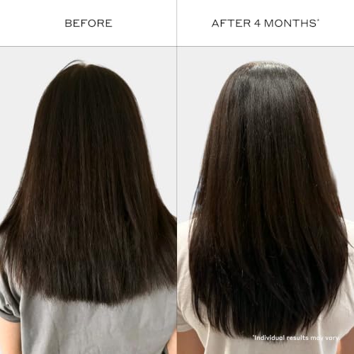 Zenagen Revolve Conditioner for Thinning Hair | Thickening & Volumizing