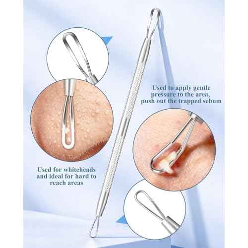 3PCS Pimple Extractor Acne Treatment Tool Professional Stainless Blackhead Comedone Removal Popper Tool for Face Nose Blackhead Extractor Tool (Silver)