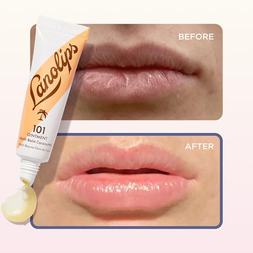 Lanolin 101 Multipurpose Ointment - Lip Balm & Skin Moisturizer