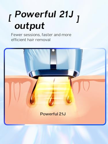 Blex Laser Hair Removal Device Blue - IPL Hair Removal for Women & Men, Fast & Painless, Permanent Results