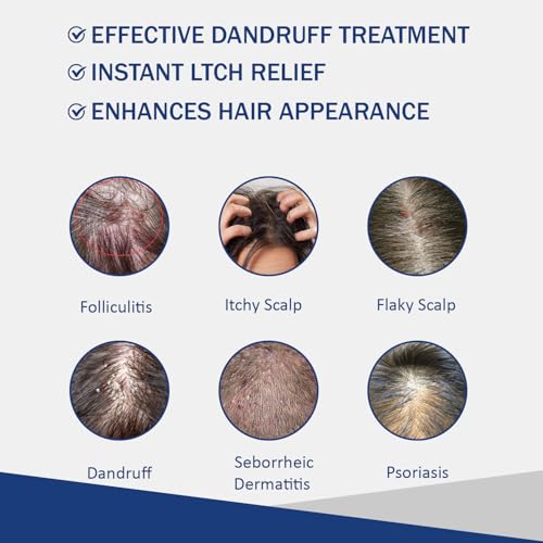 Sulfate Free Anti Fungal Shampoo for Folliculitis & Dandruff