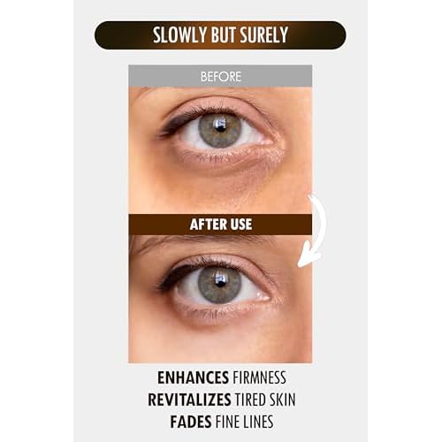 SUR.MEDIC+ 24K Gold Perfection All In One Cream for Face & Eye with Hyaluronic Acid, Panthenol and 24 Gold 1.18 oz