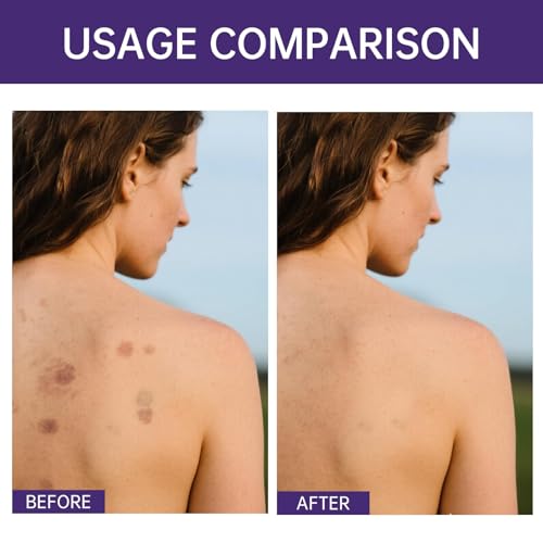 Waterproof Tattoo Cover Up Makeup with Brush – Full Coverage Body Concealer