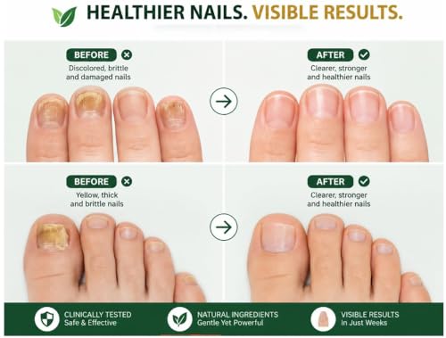 Nail Treatment 0.5oz - Healthy Nails Formula with Brush Applicator