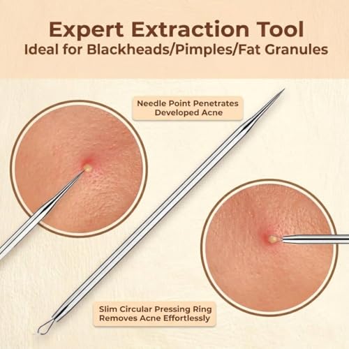 Blackhead Remover Tool Set - 2 Pcs Comedone Extractor Kit
