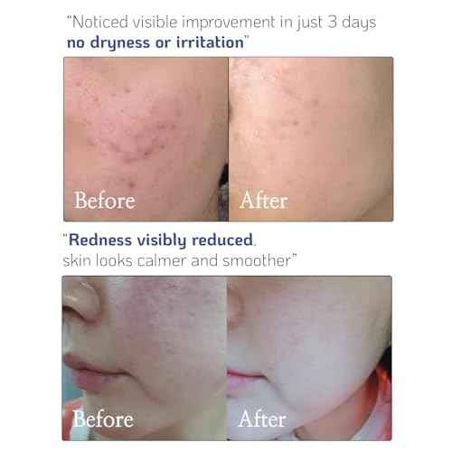 Versatile High-Potency Ceramide Concentrate Mix 1-2 Drops with Any Product Hydrating Moisturizer Enhancer Strengthening Skin Barrier 41ml