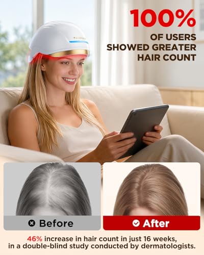 Viconor FDA Cleared Red Light Therapy Laser Cap for Hair Growth