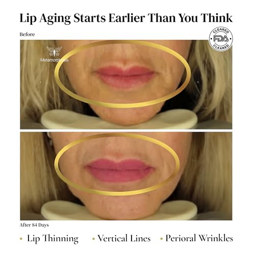 LushLips Red Light Therapy Device for Lip Lines & Volume
