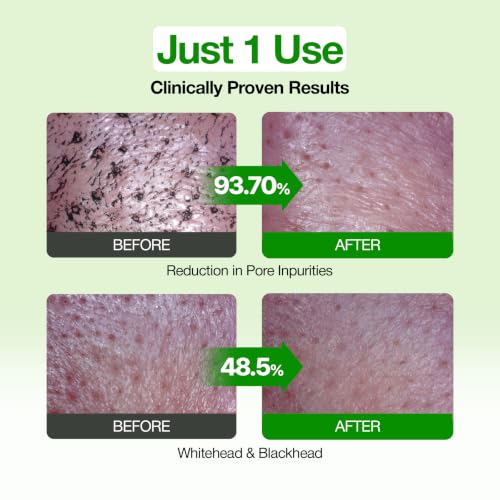 FULLY Green Tomato Clay Mask Cleanser | 2-Minute Pore Detox