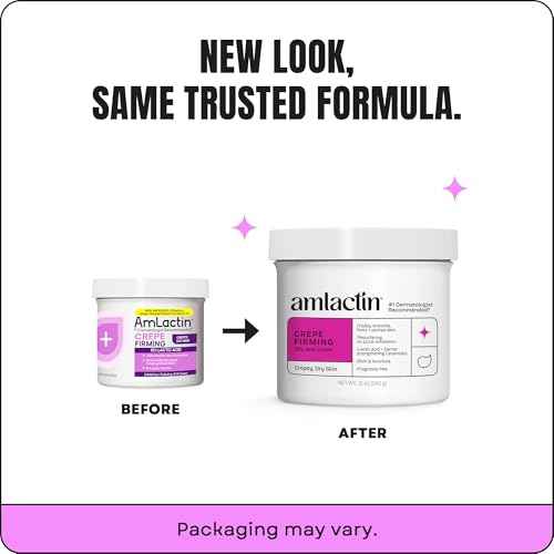 AmLactin Crepe Firming Cream - Therapeutic Skin Tightening Cream for Body – No-Scrub Exfoliator and Moisturizer with 15% Lactic Acid AHA, 12 oz (Packaging May Vary)