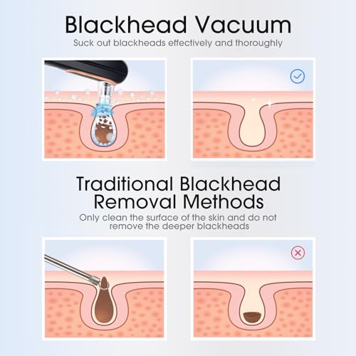 Yccu Blackhead Remover Vacuum Pore Extractor - 4 Modes, 5 Heads, USB Rechargeable