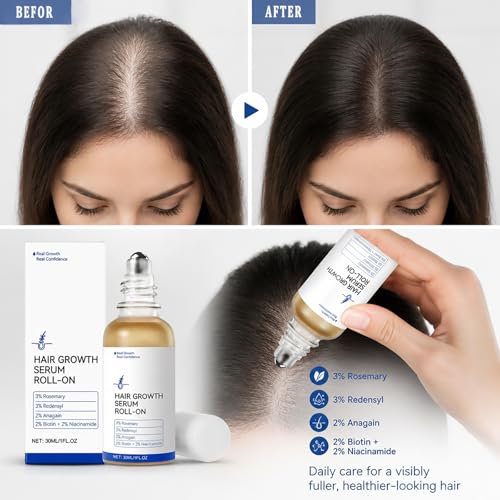 Hair Growth Serum Roll-On with Rosemary - Strengthens Roots & Supports Hairline