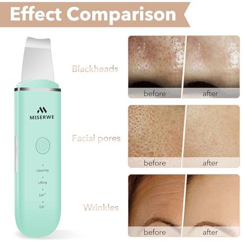 MISERWE Face Skin Scrubber with 4 Modes - Pore Cleaner & Facial Exfoliator