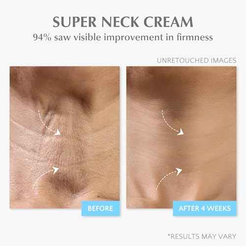 EnaSkin Retinol Collagen Face Cream: Wrinkle Cream for Women, Neck & D?collet? Anti Aging Moisturizer with 7% Hyaluronic Acid Serum - Day/Night Skin Firming & Tightening, 1.7 Oz