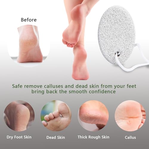 Borogo Natural Volcanic Pumice Stone Foot Callus Remover (4 Pack)