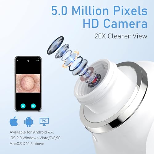 Ottleba HD Camera Blackhead Remover with 3 Suction Modes